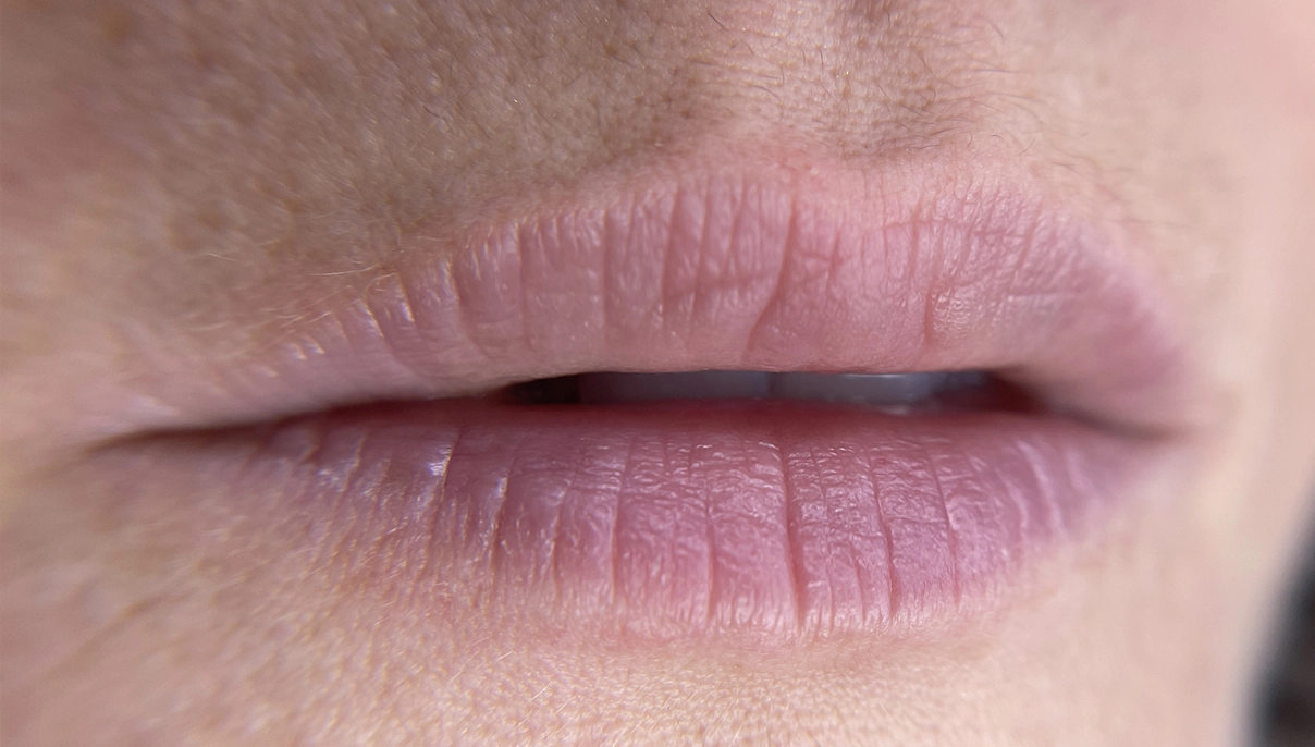 breezy_lips_before2